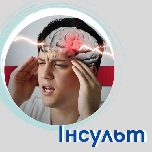 Що таке інсульт та як його розпізнати?