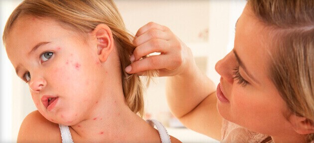 Обережно - Скарлатина