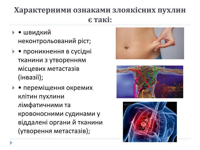 Комунікаційна стратегія щодо профілактики злоякісних новоутворень