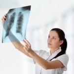 Що потрібно знати про лікування туберкульозу